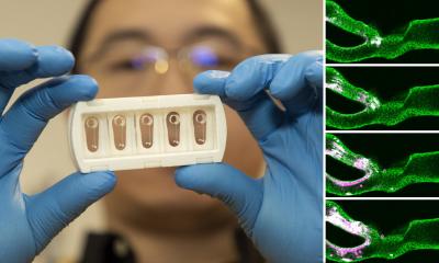 'Artery on a chip' could unravel secrets of strokes