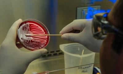 Research reveals &lsquo;hidden movement&rsquo; of Pseudomonas aeruginosa