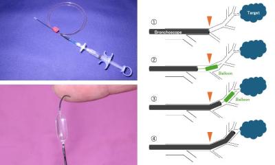 New technique opens route to previously unreachable lung tumors