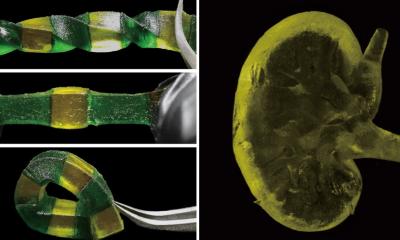 Print, stretch, implant: new material could help build artificial organs