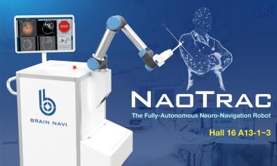 Brain Navi &bull; NaoTrac