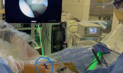 Surgical device increases range of motion in hip arthroscopy