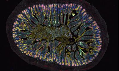 Allergies: central role of the "gut brain" discovered