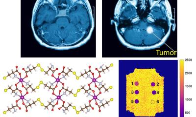 New material to make MRI contrast agents greener, safer, sharper