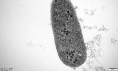 New phages spark hope against hospital superbug