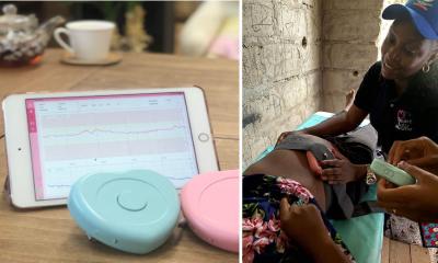 Mobile fetal heart monitoring linked to fewer newborn deaths