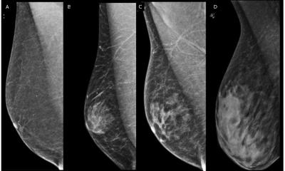 Breast imaging for male and transgender patients: bridging the knowledge gap