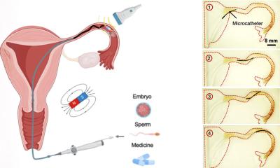 Magnetic microcatheter to improve fertility treatment