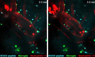 Injection could protect the brain after a stroke