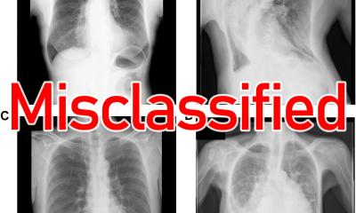 AI labeling in radiology: filling in the missing step