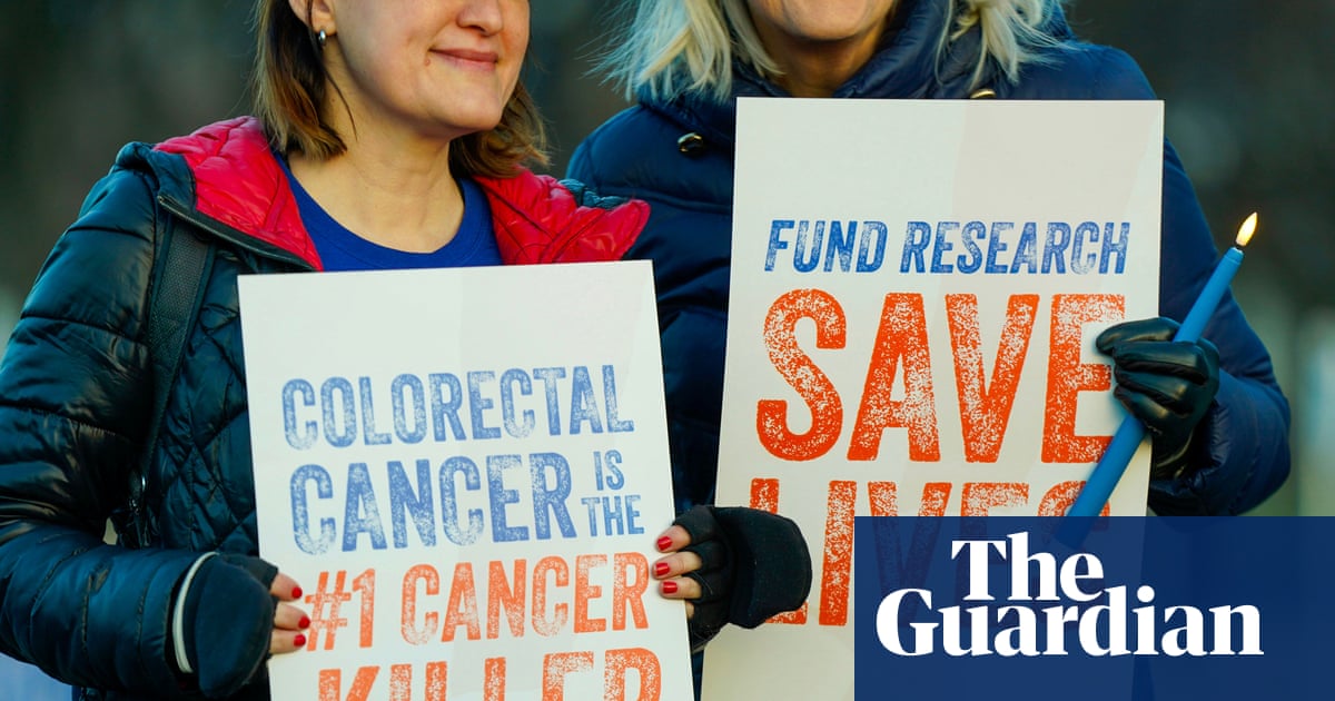 Colon cancer now leading cause of cancer deaths under 50 in US