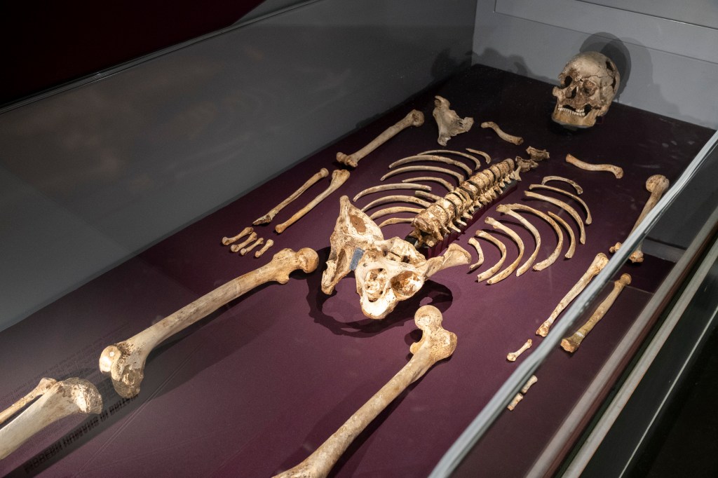 Scholars and MPs Call UK Museums ‘Unethical’ and ‘Sacrilegious’ for Holding Vast Collections of Human Remains