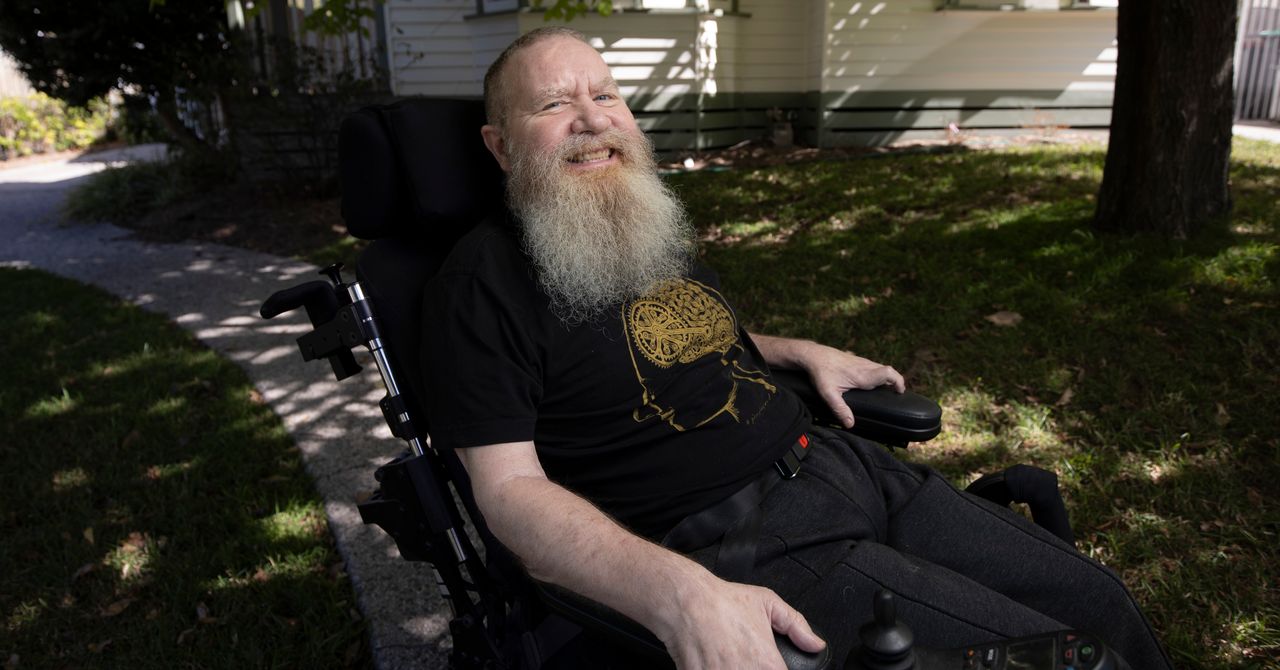 What It&rsquo;s Like to Have a Brain Implant for 5 Years