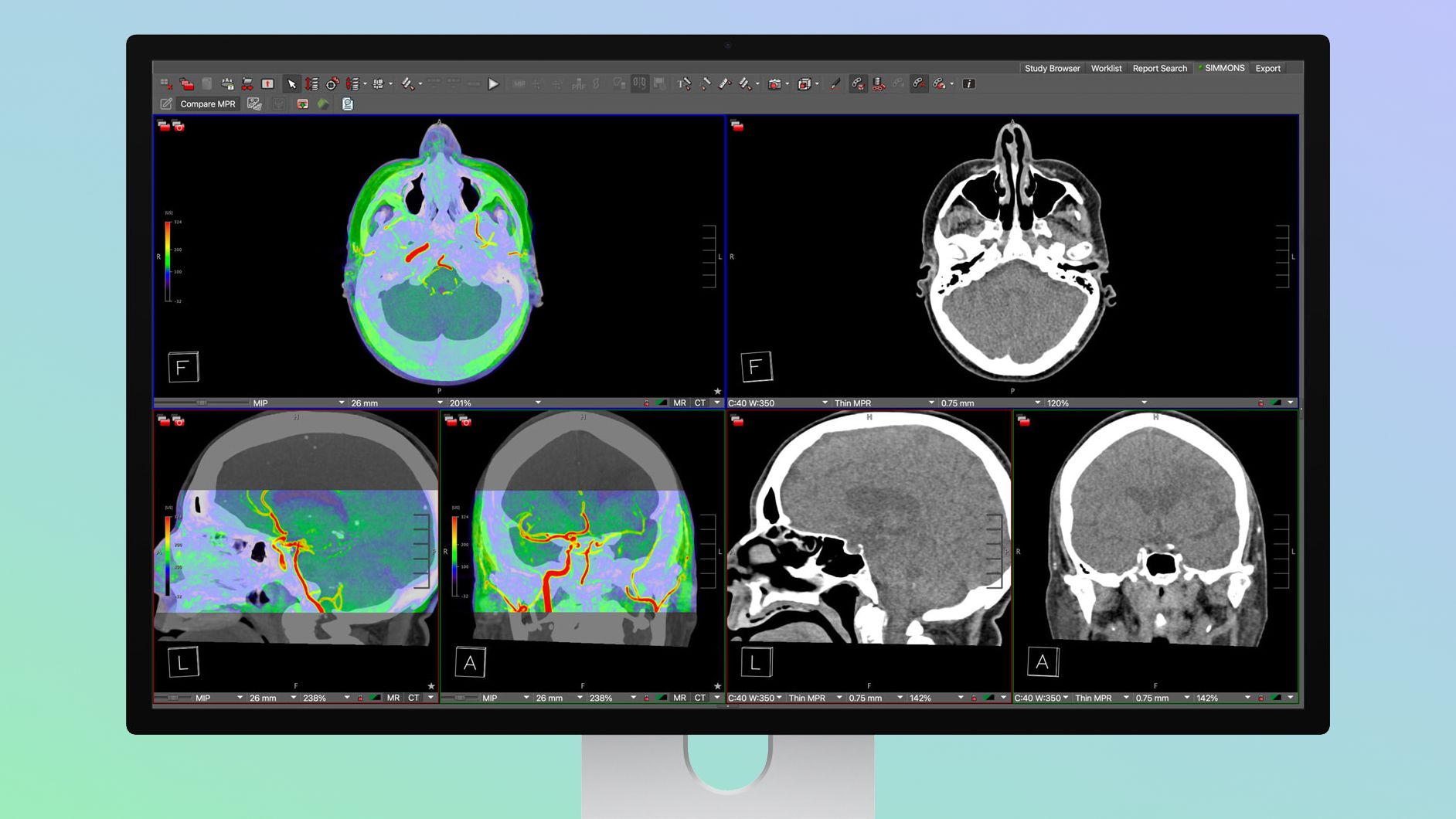 Apples Studio Display XDR Supports DICOM Medical Imaging for Diagnostic Radiology